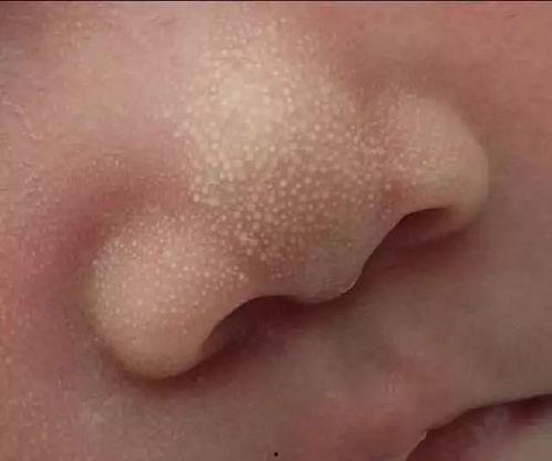 吃小白瓜嘴角起泡,嘴角起泡的甜蜜诱惑